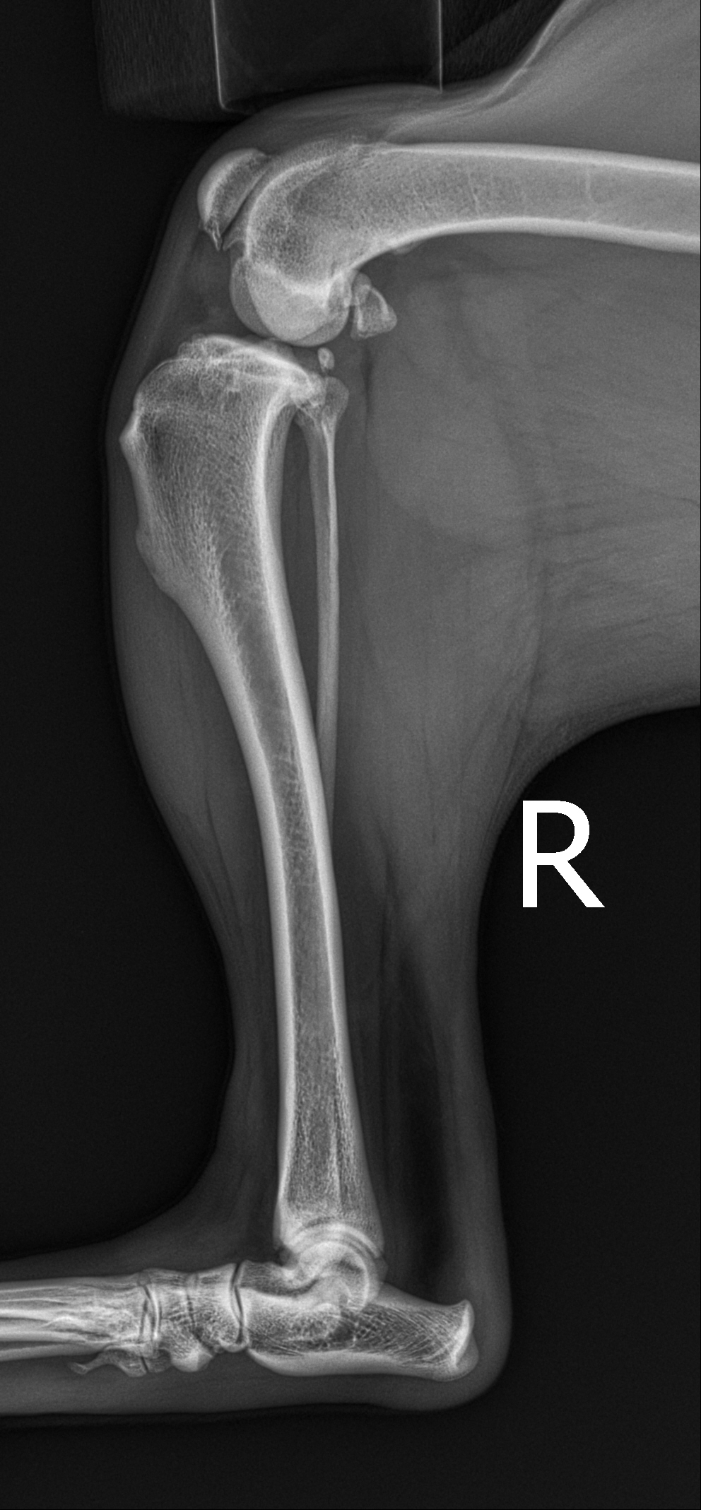 Knie
